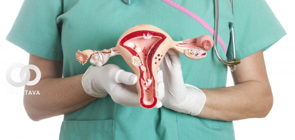 Cáncer uterino