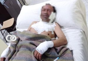 Una mujer prendió fuego al rostro de su esposo