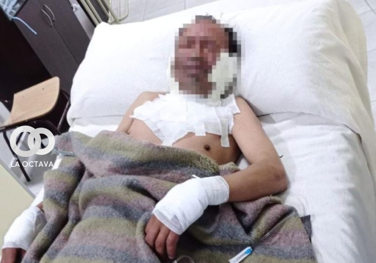 Una mujer prendió fuego al rostro de su esposo