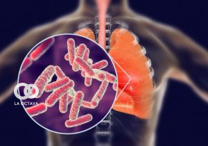 Caso de Tuberculosis