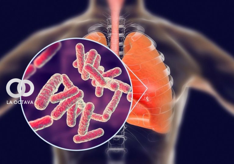Caso de Tuberculosis