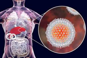 Casos de Hepatitis