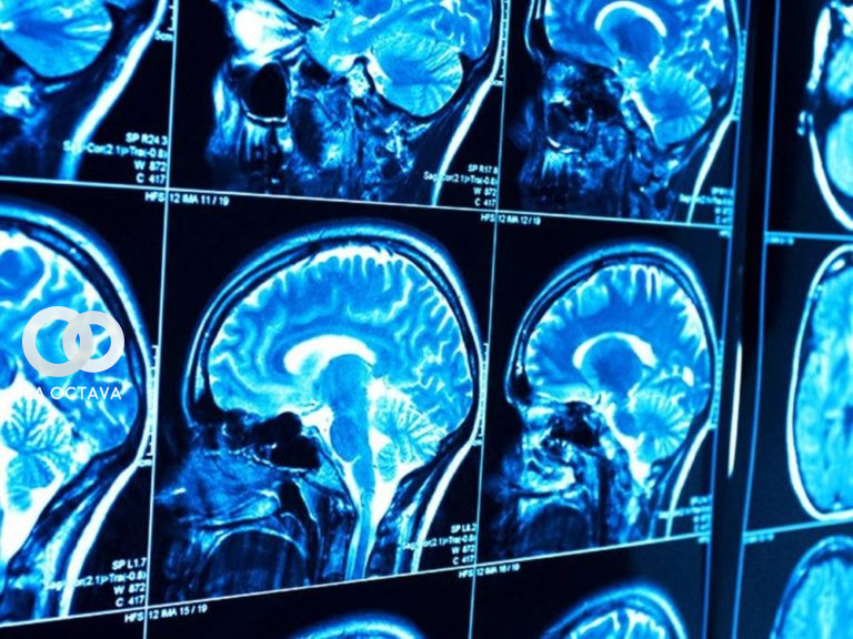Frecuencia del sistema neurológico por Covid-19.