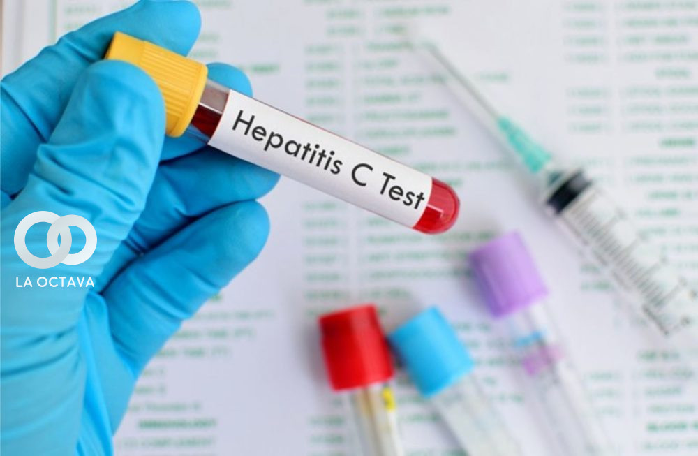 Hepatitis C Test. 
