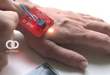 Implante de microchip en la mano. 