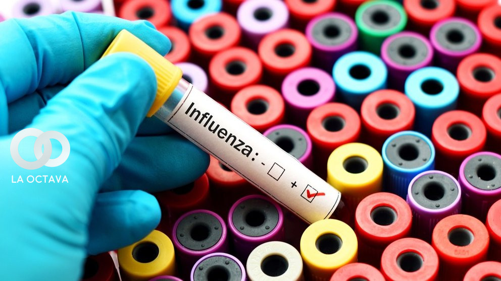 Imagen referencial de una prueba de laboratorio para influenza.