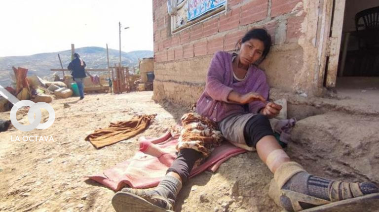 Dionisia Choque, de 36 años, quien sufrió la picadora de una araña viuda negra.