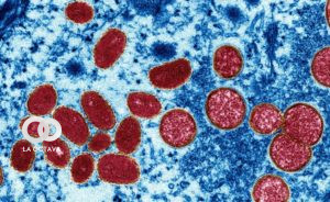 Virus de la viruela del mono