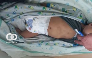Menor de ocho meses fue maltratado por sus progenitores